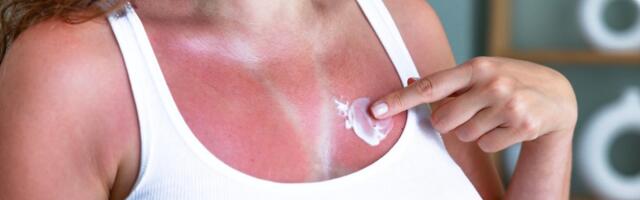 Päikselised rannailmad on kohal_ mis peitub lühendite UV ja SPF taga ning kuidas end päikese ohtliku mõju eest kaitsta?