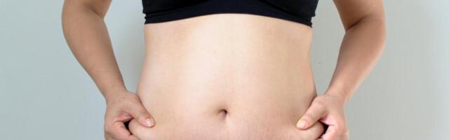 Sul on palju venitusarme? Niimoodi oleks tark toimida, et neid rohkem ei tekiks