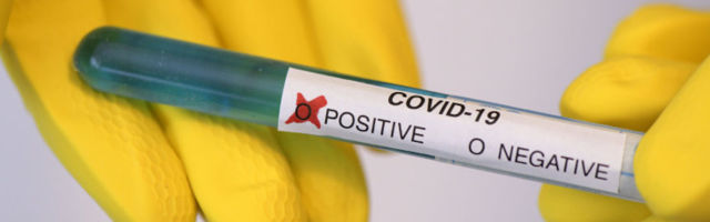 GRAAFIK | Terviseamet: ööpäevaga uusi positiivseid koroonateste ei lisandunud