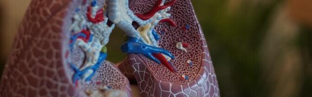 Arstid hoidsid meest kaks ööpäeva ilma kopsudeta elus