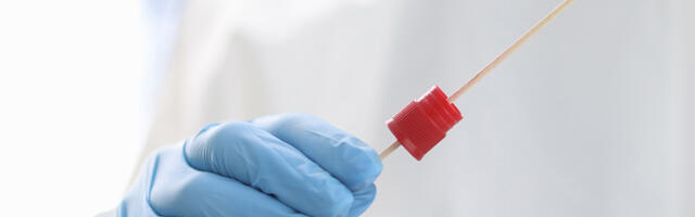 Koroonaviiruse statistika Eestis, 17. jaanuar 2022: haiglas on 309 patsienti