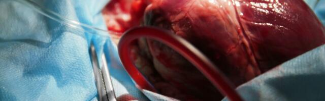 Saksa teadlased hakkavad inimestele südame siirdamiseks sigasid aretama