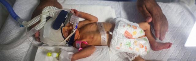 IMET EI SÜNDINUD ⟩ Gazas õhurünnakus hukkunud ema kõhust päästetud imik suri arstide pingutuste kiuste