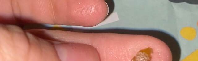 Ostja leidis Soomes poes lahtiste kommide hulgast klaasikillu – poe riiulid tühjendati