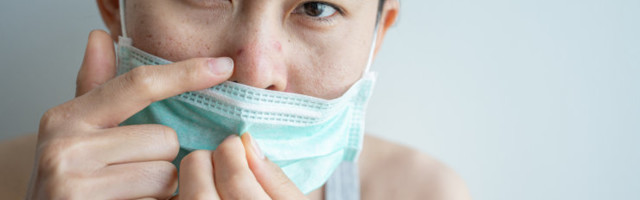 Head soovitused: kuidas vältida maski kandmisest tekkivaid näonaha probleeme ehk masknet?