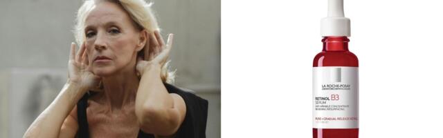 Bore na dekolteu odaju godine, ali postoje načini da ih ublažite