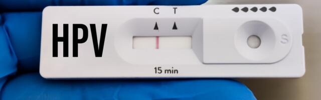 Uuring: HPV kodutest tõi rohkem naisi sõeluuringule