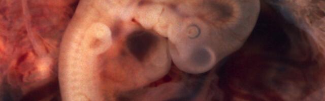 Teadlased lõid esmakordselt inimese naharakkudest pärit DNA-d kasutades embrüo