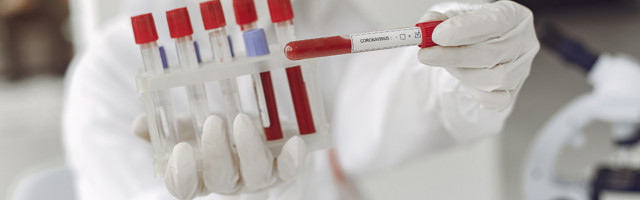 Koroonaviirus Eestis, 8. august 2021: ööpäevaga lisandus 126 positiivset