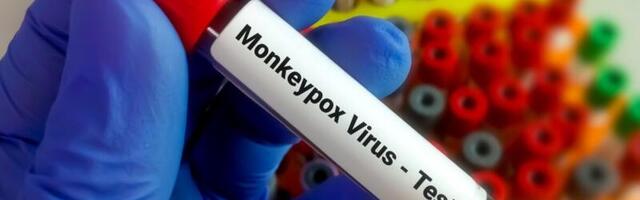 WHO kuulutas ahvirõugete leviku tõttu välja üleilmse hädaolukorra