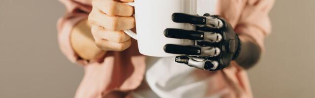 Naisel katsetatud biooniline käsi parandas tema elu märgatavalt