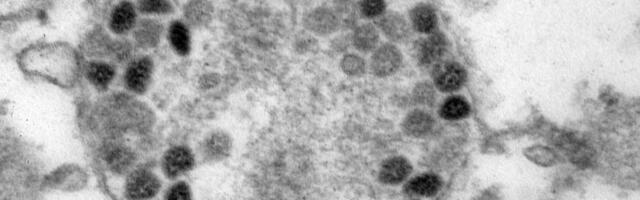 Uuringute järgi näib koroonaviiruse omikrontüvi olevat leebem, aga lööb juhtumite arvuga