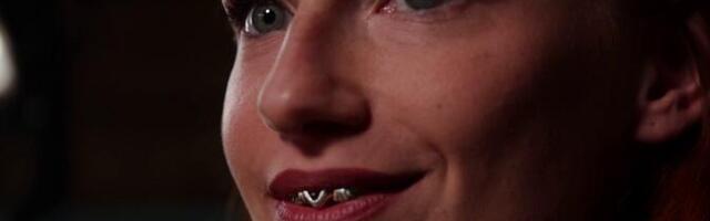 Дизайнер украшений Лийсбет Кирсс: на изготовление грилзов вдохновили бабушкины золотые зубы