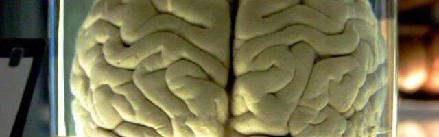 Teadlased kaardistasid esimest korda aju täieliku aktiivsuse otsuste tegemise ajal