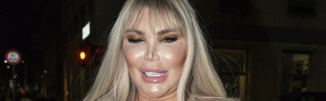 Üüratuid summasid iluoperatsioonidele kulutanud Inim-Keni rikkus kasvab veelgi: staar saab isalt päranduseks miljoneid