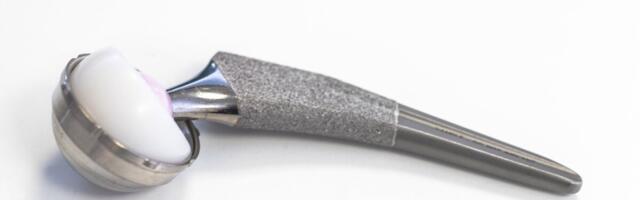 Uuring: puusaliigese proteesid kestavad nüüd kuni veerandsada aastat