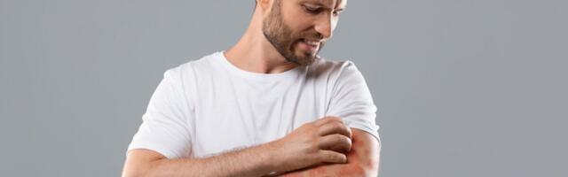 Psoriaasi bioloogilised ravimid võivad ära hoida ka psoriaatilist artriiti