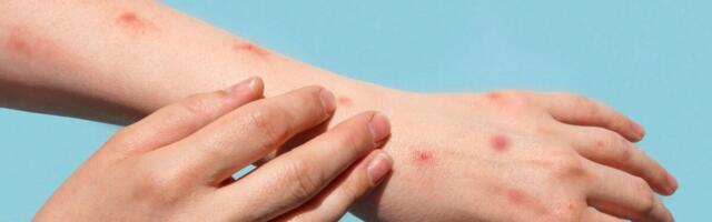 Ahvirõugete vaktsiin jõudis regioonikeskustesse