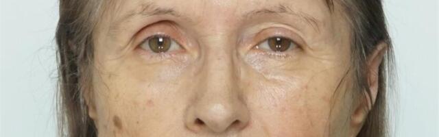 LEITUD: Politsei otsib Lasnamäel kadunud 73-aastast Fainat