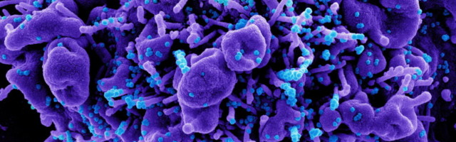 India tüve juhtumite arv võib Eestis märgatavalt tõusta