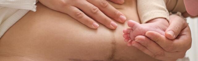 Kaire Sildver kaitseb doktoritööd operatiivsetest sünnitustest Eestis ja Soomes