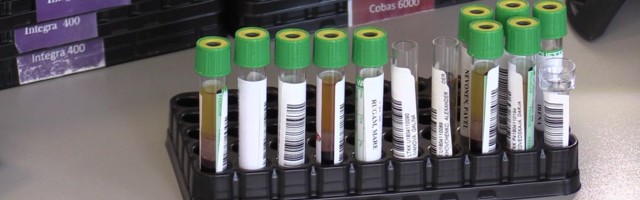 Reporter: Ida-Virumaal jõudis haigestumus koroonaviirusesse kriitilisse seisu