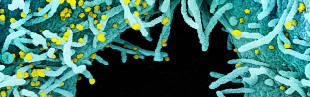 Paljulubavad arengud: antikehade kokteil hoidis laboriloomadel ära COVID-19