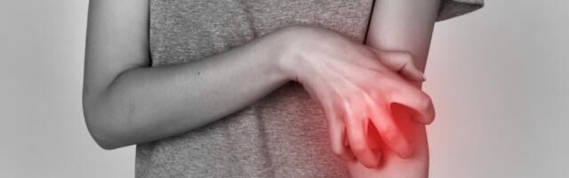 Terviseamet: Kui meetmetest kinni peetakse, on sügeliste leviku võimalus väga väike