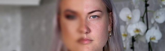 VIDEO | Mis ilukirurgia? Vaata, kuidas saab meigi abil enda nägu totaalselt muuta