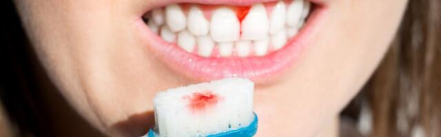 Igemehaigused võivad olla seotud COVIDi raske põdemisega