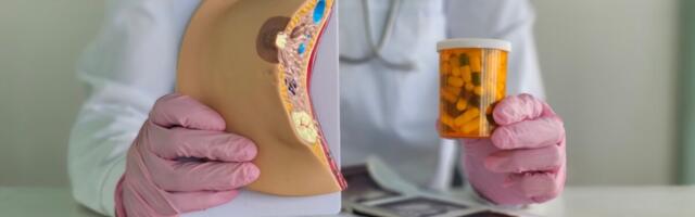 Uuring: megestrool võib tugevdada rinnavähi hormoonravi toimet