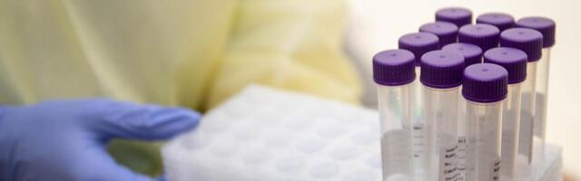 WHO: Ukraina põgenikest johtuvat COVIDi-lainet pole põhjust peljata. Seda kinnitavad ka esimesed Eesti andmed