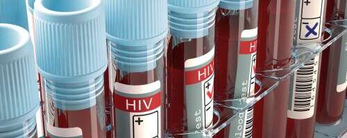 HIV: Ära põe, parem testi!