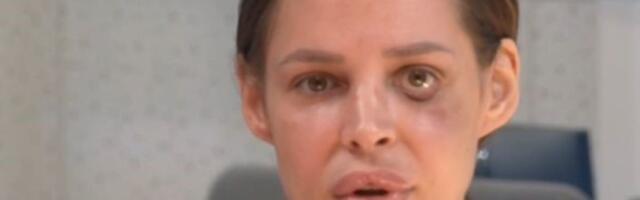 "Deformisana sam" Šavija je ovako govorila o nasilju koje je doživela od Stefana Karića: Izrečena mu presuda