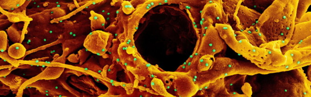 India tüve juhtumite arv Eestis kasvas taas