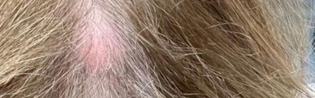 Naine arvas, et ta peas on muhk, kuid tegelikult...