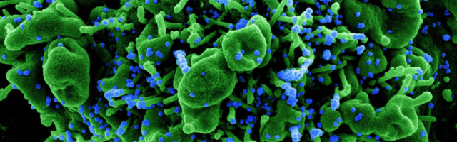 Lutsar: Eestis on avastatud juba ligi 30 koroonaviiruse ohtliku nn Suurbritannia tüvega nakatumist