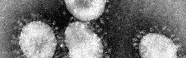 Kiik: koroonaolukord on stabiliseerunud vastuvõtmatult kõrgel tasemel