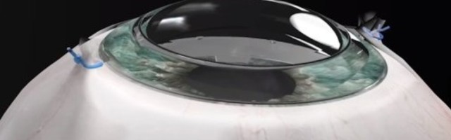 VIDEO | Uut tüüpi tehis-sarvkest võib nägemise taastada