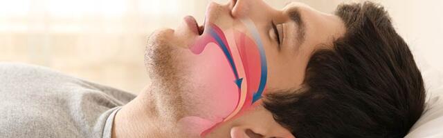 Kas norskamine võib olla ohtlik