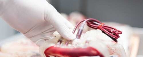 COVID-19 teise laine patsientide ravimiseks otsitakse vereplasmadoonoreid