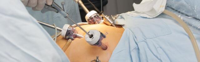 Eestis ja Soomes tehakse pea sama palju  maovähendusoperatsioone