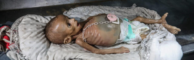 ÜRO: peaaegu kolmandik Gaza elanikest ei söö päevi järjest