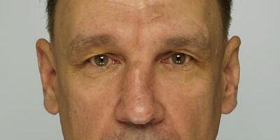 Politsei otsib vägistamises kahtlustatava mehe kannatanuid