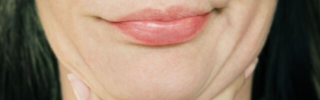 Niimoodi saad lõualotist lahti