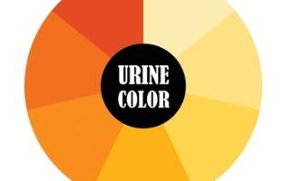 Perearstid hakkavad taas kasutama uriiniratast haiguste diagnoosimiseks