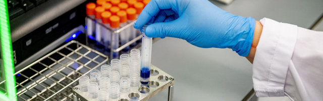 GRAAFIK | Terviseamet: ööpäevaga lisandus kaheksa positiivset koroonatesti, surmajuhtumeid polnud