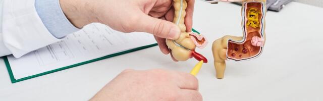 Pimesoolepõletikujärgne antibakteriaalne ravi võib olla ka lühem