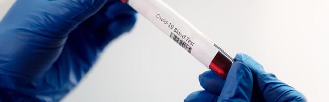 Terviseameti ülevaade COVID-19 levikust: nakatumine kasvab, kooli algus võib viiruse levikut veelgi hoogustada