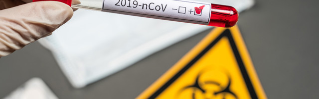 Koroonaviirus Eestis, 8. oktoober 2021: ööpäevaga lisandus 954 positiivset testi